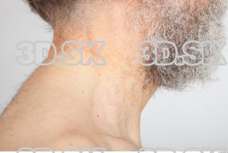 Neck texture of Roger 0004